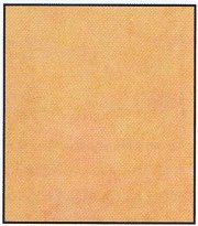 Skin texture after microdermabrasion